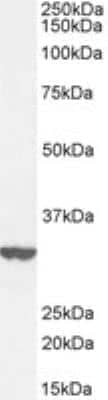 Western Blot: ITM2B Antibody [NBP1-36963]