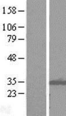 Western Blot: ITM2B Overexpression Lysate [NBL1-12082]