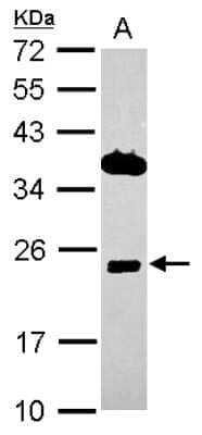 Western Blot: ITM2C Antibody [NBP2-17001]