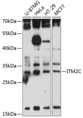 Western Blot: ITM2C AntibodyAzide and BSA Free [NBP3-04539]