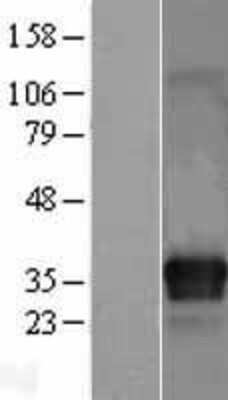 Western Blot: ITM2C Overexpression Lysate [NBL1-12083]