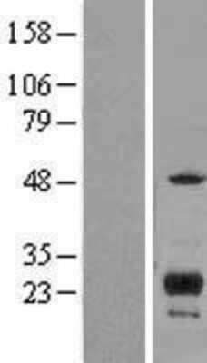 Western Blot: ITM2C Overexpression Lysate [NBL1-12084]