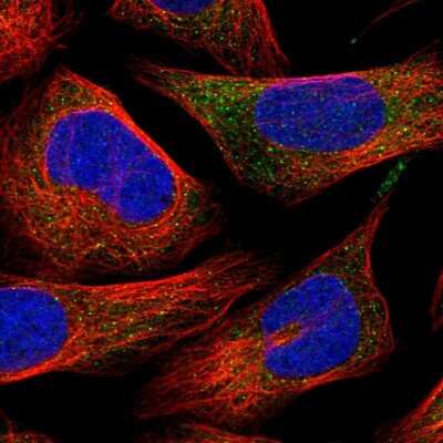 Immunocytochemistry/ Immunofluorescence: ITPA Antibody [NBP1-88296]