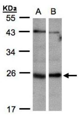 Western Blot: ITPA Antibody [NBP1-32494]