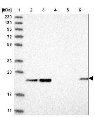 Western Blot: ITPA Antibody [NBP1-88296]