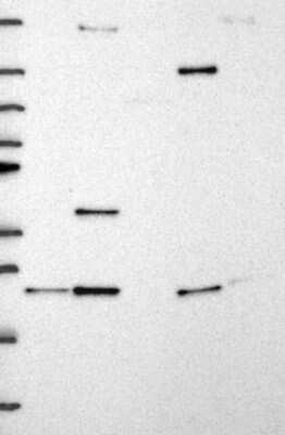 Western Blot: ITPA Antibody [NBP3-17266]