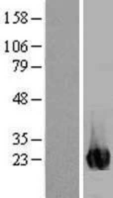 Western Blot: ITPA Overexpression Lysate [NBL1-12086]