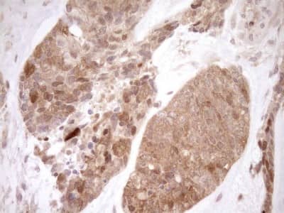 Immunohistochemistry: ITPK1 Antibody (OTI1F5) [NBP2-45463]