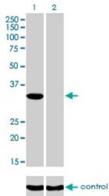 Western Blot: ITPK1 Antibody (2C8) [H00003705-M01]