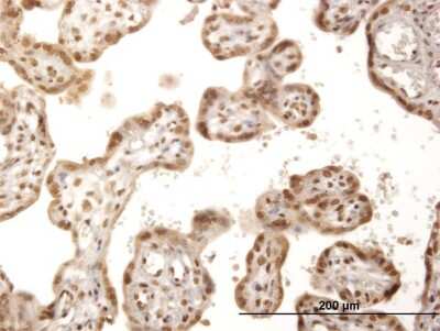 Immunohistochemistry-Paraffin: ITPK1 Antibody [H00003705-B01P]