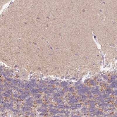 Immunohistochemistry-Paraffin: ITPK1 Antibody [NBP2-48686]