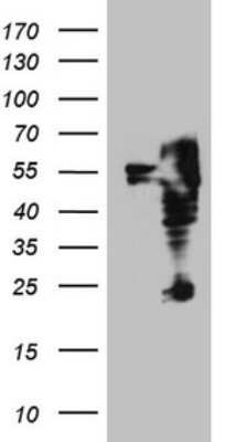 Western Blot: ITPK1 Antibody (OTI1F5)Azide and BSA Free [NBP2-71052]