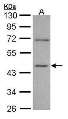 Western Blot: ITPK1 Antibody [NBP1-32678]