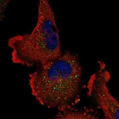 Immunocytochemistry/ Immunofluorescence: ITPKA Antibody [NBP1-81590]