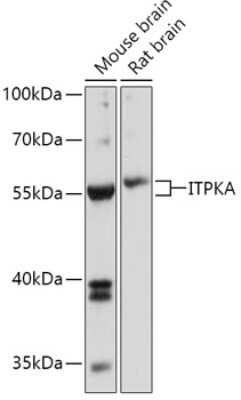 Western Blot: ITPKA AntibodyAzide and BSA Free [NBP3-04719]