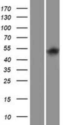 Western Blot: ITPKA Overexpression Lysate [NBP2-08138]