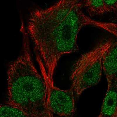 Immunocytochemistry/ Immunofluorescence: ITPKB Antibody [NBP2-57395]