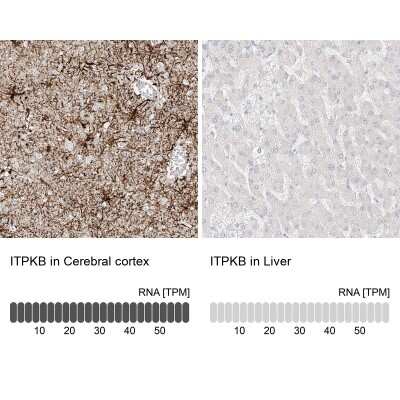 Immunohistochemistry-Paraffin: ITPKB Antibody [NBP1-81589]