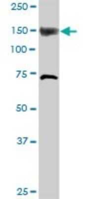 Western Blot: ITPKB Antibody [H00003707-D01P]