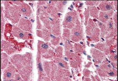 Immunohistochemistry-Paraffin: ITPR2 Antibody [NB100-2466]