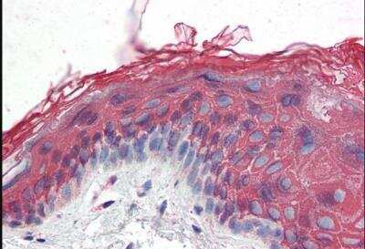 Immunohistochemistry-Paraffin: ITPR2 Antibody [NB100-2466]