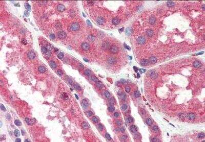 Immunohistochemistry-Paraffin: ITPR2 Antibody [NB100-2466]