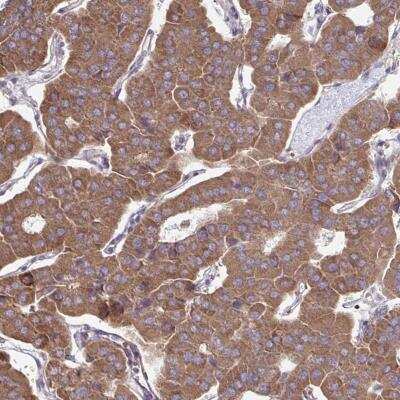 Immunohistochemistry-Paraffin: ITPR2 Antibody [NBP2-49294]