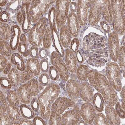 Immunohistochemistry-Paraffin: ITPR2 Antibody [NBP2-49294]