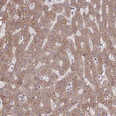 Immunohistochemistry-Paraffin: ITPR2 Antibody [NBP2-49294]