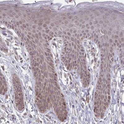 Immunohistochemistry-Paraffin: ITPR2 Antibody [NBP2-49294]