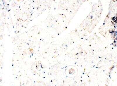 Immunohistochemistry-Paraffin: ITPR2 Antibody [NBP3-12318]