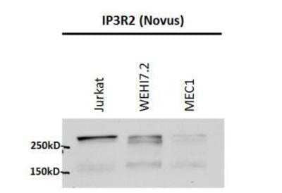 Western Blot: ITPR2 Antibody [NB100-2466]