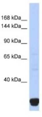 Western Blot: ITPR2 Antibody [NBP3-10355]