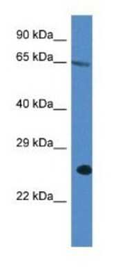 Western Blot: ITPRIP Antibody [NBP1-79876]