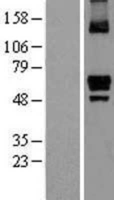 Western Blot: ITPRIP Overexpression Lysate [NBL1-12278]