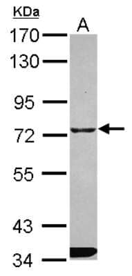 Western Blot: ITPRIPL1 Antibody [NBP2-17002]