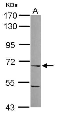 Western Blot: ITPRIPL1 Antibody [NBP2-17003]