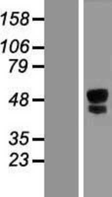 Western Blot: ITPRIPL1 Overexpression Lysate [NBL1-12279]