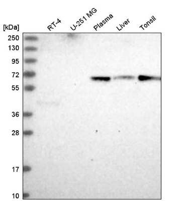 Western Blot: ITPRIPL2 Antibody [NBP2-58997]