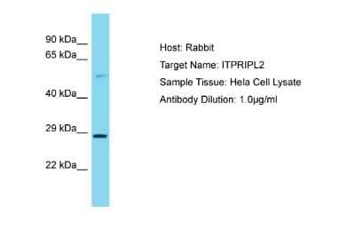 Western Blot: ITPRIPL2 Antibody [NBP2-83089]