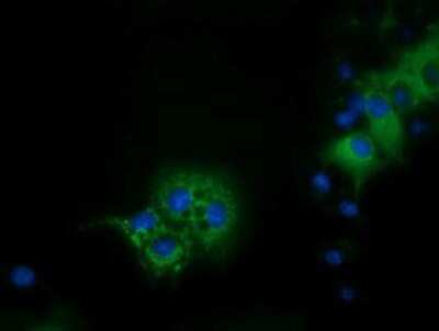 Immunocytochemistry/ Immunofluorescence: IVD Antibody (OTI1B10) [NBP2-03047]