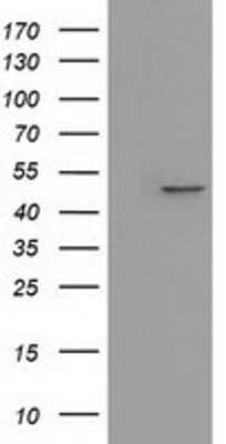 Western Blot: IVD Antibody (OTI1B10) [NBP2-03047]