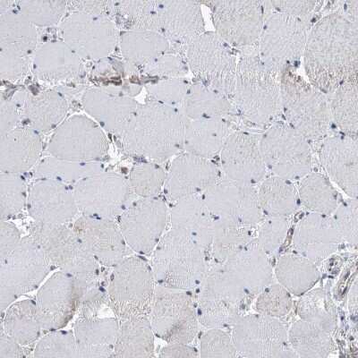 Immunohistochemistry-Paraffin: IVD Antibody [NBP2-30578]