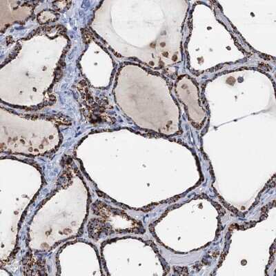 Immunohistochemistry-Paraffin: IVD Antibody [NBP2-30578]