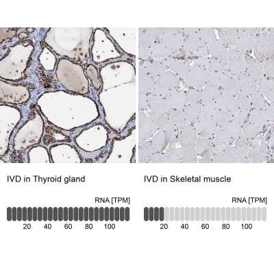 Immunohistochemistry-Paraffin: IVD Antibody [NBP2-30578]