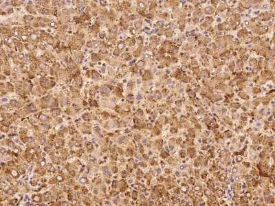 Immunohistochemistry-Paraffin: IVD Antibody [NBP2-99159]