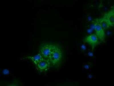 Immunocytochemistry/ Immunofluorescence: IVD Antibody (OTI1B10) - Azide and BSA Free [NBP2-71055]