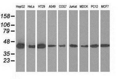 Western Blot: IVD Antibody (OTI1B10)Azide and BSA Free [NBP2-71055]