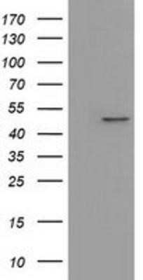 Western Blot: IVD Antibody (OTI1B10)Azide and BSA Free [NBP2-71055]