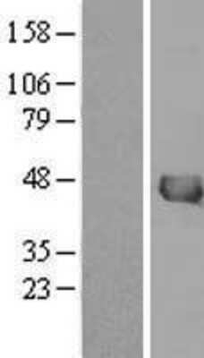 Western Blot: IVD Overexpression Lysate [NBL1-12088]